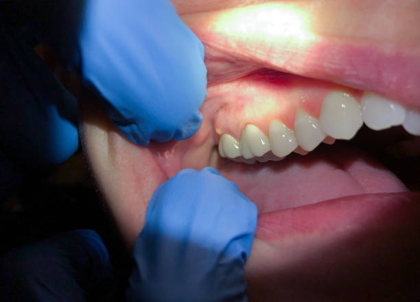 Best Pediatric Emergency Dentist in Friedens, PA