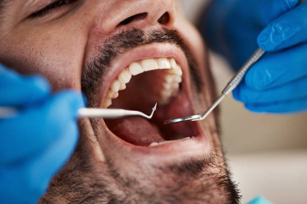 Best Emergency Tooth Extraction in Friedens, PA